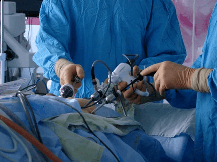 Intervención cirúrxica
